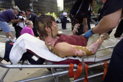 Burn victim, Virginia DiChiara, escapes a fate nearly 700 of her colleagues at Cantor Fitzgerald did not. American Airlines Flight 11 crashed into the north tower as DiChiara stood in the elevator just 20 floors below the impact site. After walking down 78 flights of stairs with 2nd and 3rd degree burns covering over 30% of her body, she is tended to by paramedics shortly before the towers collapse.